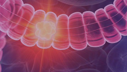 Colorectal.png