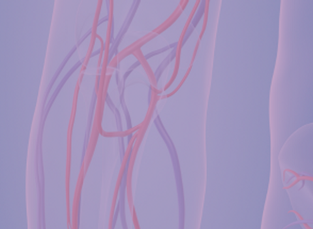 Vascular access devices for people with cancer vascular access devices for people with cancer.png