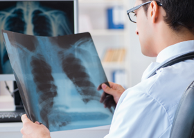 Understanding Dust-Related Disease Claims.png