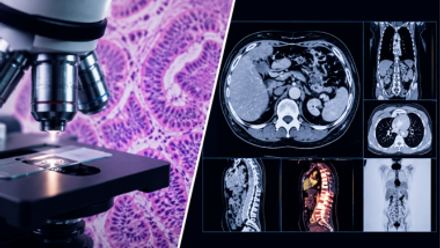 Oncology Insights Basic pathology and imaging in cancer care (1).png