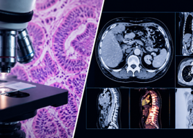 Oncology Insights Basic pathology and imaging in cancer care (1).png