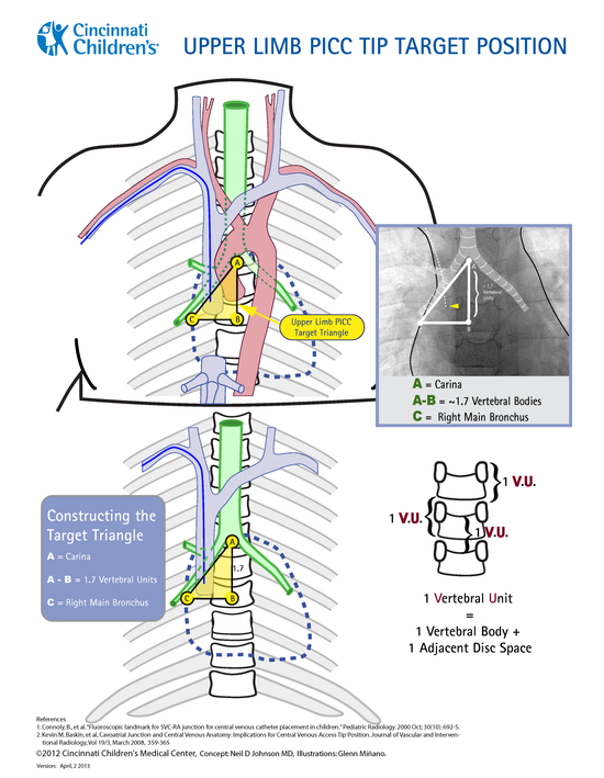 B_180912_AVA_Upper_limb_PICC.png