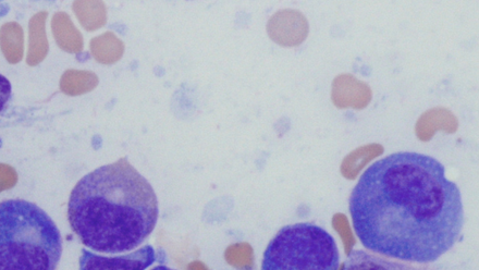 Innovation in Tele-Oncology in the Management of Multiple Myeloma.png